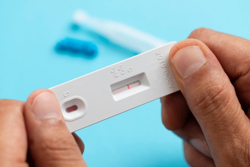 Siuslaw News | U.S., Oregon services offer free COVID testing kits & masks