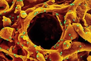 Study: Serum Neutralizing Activity of mRNA-1273 Against the SARS-CoV-2 B.1.1.529 (Omicron) Variant: A Preliminary Report. Image Credit: NIAID