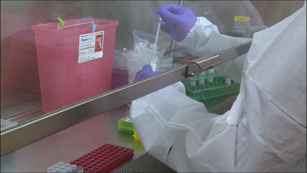 Marshfield Clinic helps state identify COVID variants