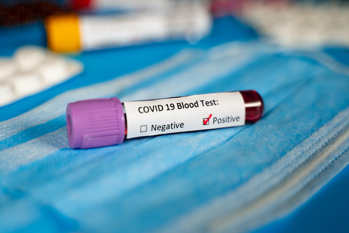 COVID-19 in Clarksville: Active cases top 4,400 locally as Omicron variant dominates