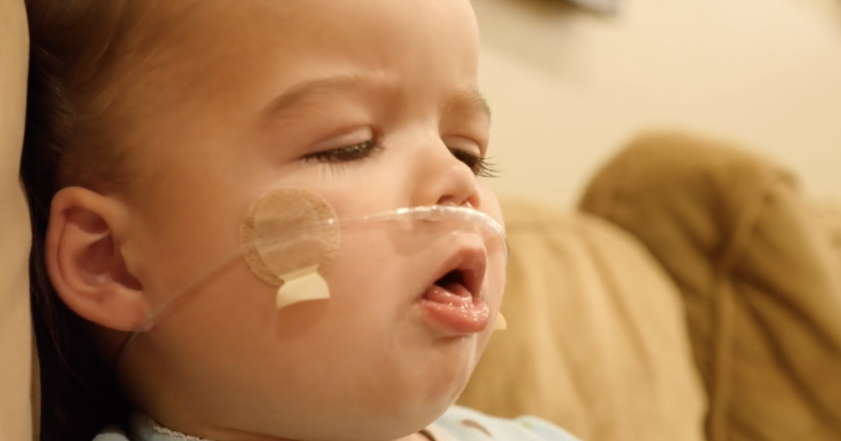 Omicron is causing more cases of croup in kids under 5